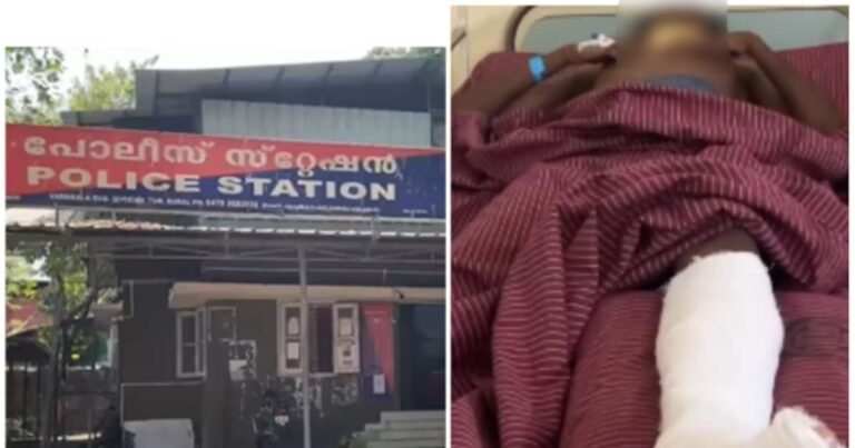 സ്കൂളിലെ ഉച്ചഭക്ഷണ ഇടവേളയിൽ പത്താം ക്ലാസുകാരനെ പ്ലസ് ടു വിദ്യാർത്ഥികൾ ക്രൂരമായി ആക്രമിച്ചു