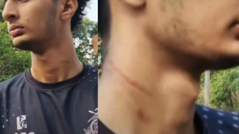 ഇൻസ്റ്റയിൽ പോസ്റ്റ് ചെയ്ത ചിത്രത്തിനിട്ട കമന്റ് ഇഷ്ടപ്പെട്ടില്ല, ക്രൂരമർദനം;4 കെ.എസ്.യു നേതാക്കൾ അറസ്റ്റിൽ
