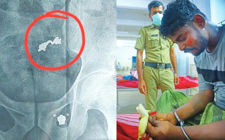 നല്ലഭക്ഷണം,ഇടയ്ക്കിടെ വാഴപ്പഴം; വിഴുങ്ങിയ തൊണ്ടിമുതൽ പുറത്തെടുക്കാൻ മോഷ്ടാവിനെ തീറ്റിപ്പോറ്റി പോലീസ്;പാലക്കാട് നടക്കുന്നത് സിനിമാസ്റ്റൈൽ