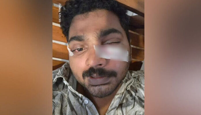 ബസില്‍ എസിയുടെ തണുപ്പു പോരാ എന്നു പറഞ്ഞ് അസഭ്യം പറഞ്ഞു; ക്ലീനറുടെ മുഖമിടിച്ച് പൊട്ടിച്ചു; പരാതിയില്‍ കേസെടുത്ത് പൊലീസ്
