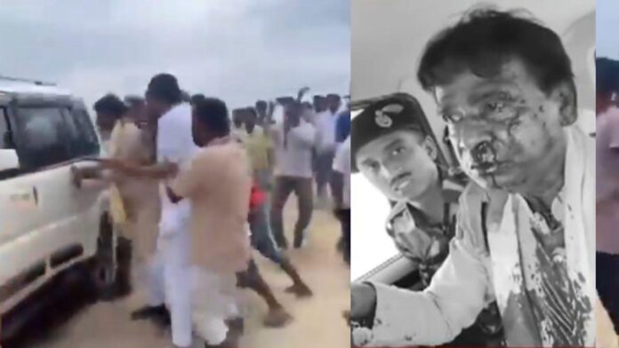ബംഗാളിലെ പ്രളയം: BJP നേതാക്കള്‍ക്കുനേരെ ജനക്കൂട്ടത്തിന്റെ ആക്രമണം; MPക്ക് ഗുരുതര പരിക്ക്, തൃണമൂലിന്റെ കളിയെന്ന് BJP