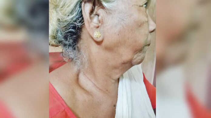 വരവുമാലയിട്ടാലും രക്ഷയില്ല, കള്ളന്റെ പിടിവലിയിൽ കഴുത്തിന് പരിക്കേറ്റ് വയോധിക