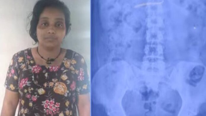 കുട്ടിയുടെ മാല മോഷ്ടിച്ച് വിഴുങ്ങി യുവതി, തൊണ്ടിമുതലിനായി പോലീസിന്റെ കാത്തിരിപ്പ്; സംഭവം നിലമ്പൂരിൽ