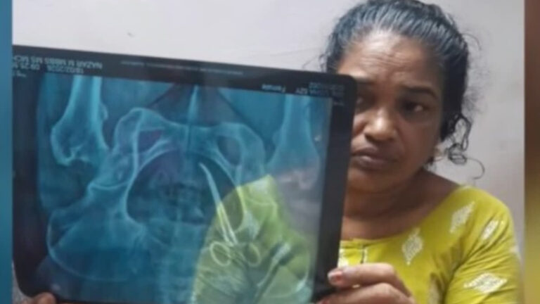 ശസ്ത്രക്രിയ ചെയ്ത് പുറത്തെടുത്ത ആര്‍ട്ടറി ഫോര്‍സെപ്‌സിന്റെ അഗ്രഭാഗം ഒടിഞ്ഞ നിലയില്‍;  ഉഷയുടെ വയറ്റില്‍ നിന്നും പുറത്തെടുത്തത് രണ്ട് ഭാഗങ്ങളായി; കത്രിക കോടതിയില്‍ ഹാജരാക്കും