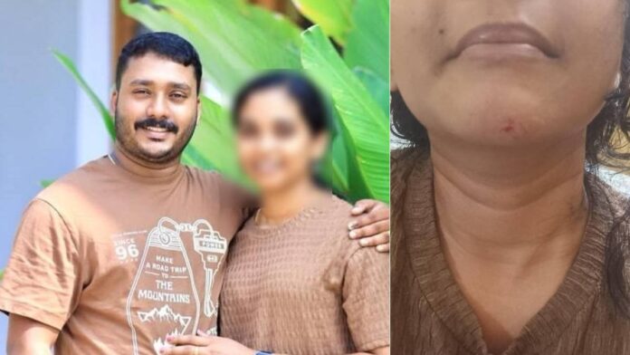 വാടകവീട്ടിൽ യുവതി മരിച്ചനിലയിൽ, ഭർത്താവ് കസ്റ്റഡിയിൽ; ഭർതൃവീട്ടിലെ പീഡനമെന്ന് പരാതി